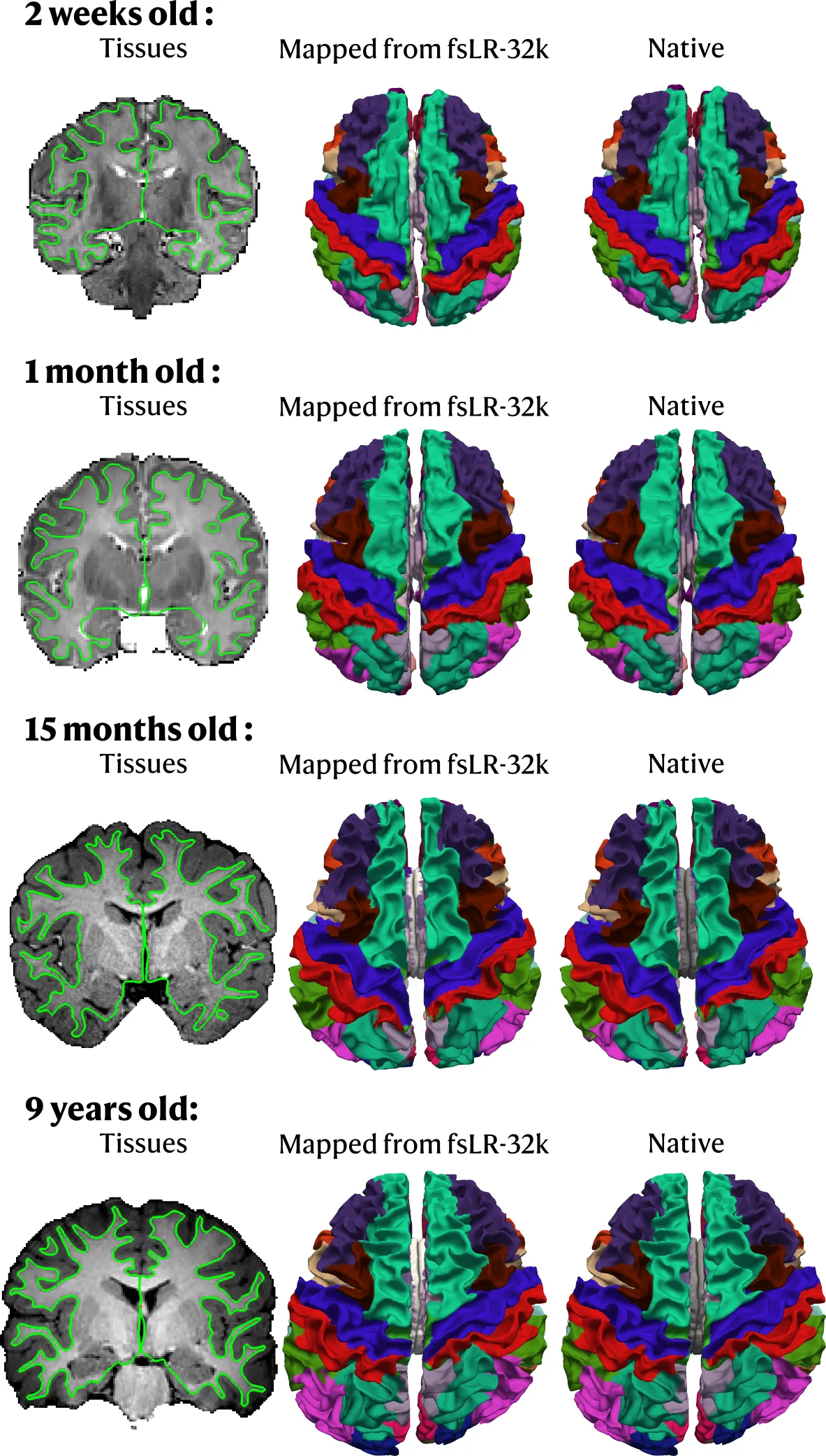 atlas mapping comparison