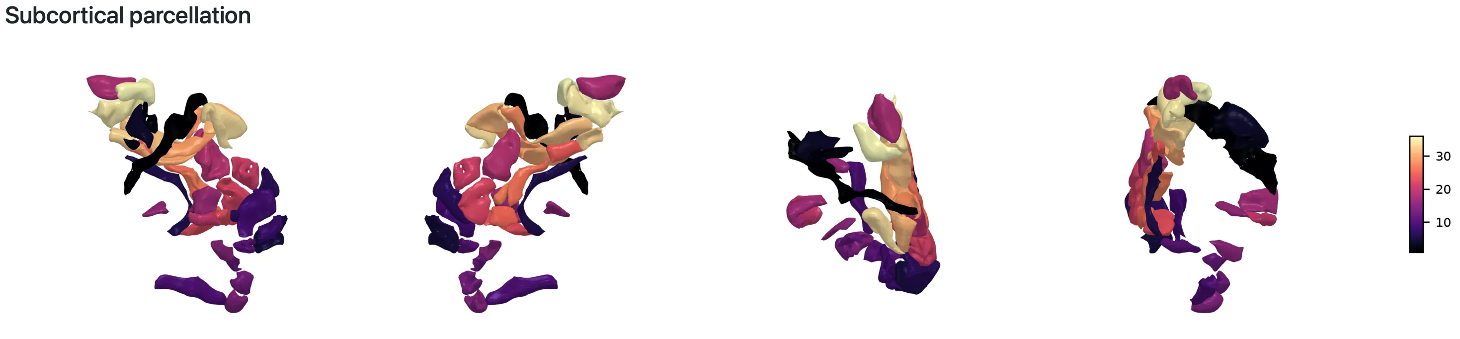 wrong_subcortical_visualization